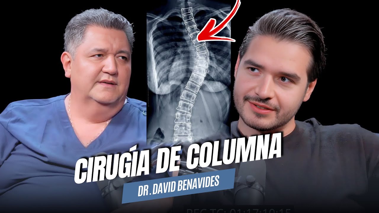 🚨Atención ❗️OPERAR tu COLUMNA solo si TIENES | Hernia, listesis, Escoliosis | Dr. David Benavides 
