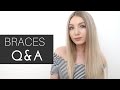 BRACES Q&A | Do braces hurt, keeping my teeth white & more!