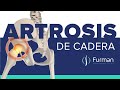 ARTROSIS DE CADERA 😡 dolor de cadera | tratamientos naturales [osteoartritis de cadera]