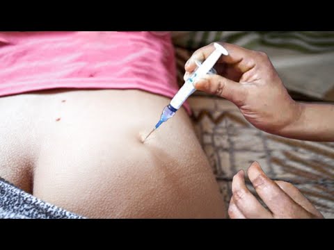 IM Intramuscular Injection Ventrogluteal 💉Ceftriaxone 500mg + Dexamethasone 🔥 Clinical Technique