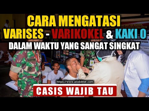 CARA MENGATASI VARISES, VARIKOKEL DAN KAKI BERBENTUK O Dengan waktu