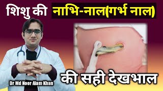 गर्भनाल की देखभाल कैसे करें || Baby cord care after birth || Dr Noor Alam Khan