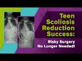 Teen Scoliosis Reduction Success: Risky Surgery No Longer Needed!