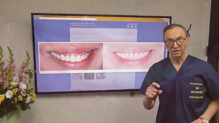 How to Fix a Gummy Smile