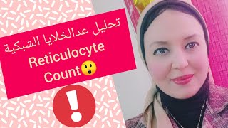 تحليل عد الخلايا الشبكية Reticulocyte count