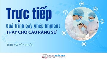 TRỰC TIẾP CA CẤY GHÉP IMPLANT THAY CHO CẦU RĂNG SỨ