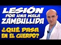 LESIÓN POR UNA MALA ZAMBULLIDA - ¿Qué pasa dentro del cuerpo de quienes la padecen?