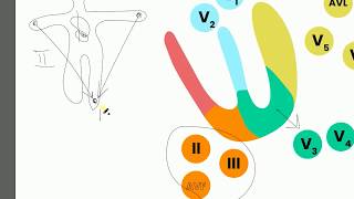 ЭКГ при инфаркте. Часть первая локализация трансмурального инфаркта