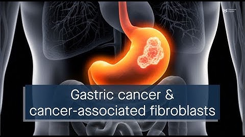 Gastric cancer–stimulated pathways in cancer-associated fibroblasts and implications for treatment