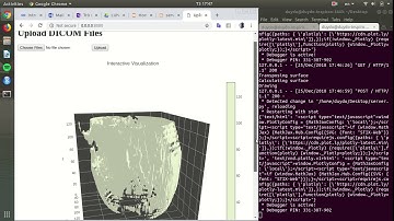 3D visualization DICOM files