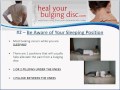 Bulging Disc Treatment | Dr. Ron Daulton, Jr. Discusses 3 Helpful Bulging Disc Treatments