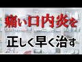 【痛い口内炎】薬の選び方と正しく、早く治す方法【薬剤師歴30年】