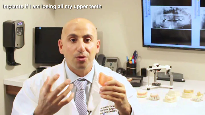 Implants if I am losing all my upper teeth? | Daniel Daniel Dentistry