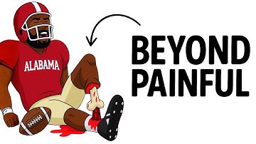 De meest pijnlijke blessures aller tijden bij American football op de universiteit