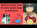 ✅  Beneficios del Jugo de la  Papa Cruda Para la Gastritis, Acidez y Reflujo.