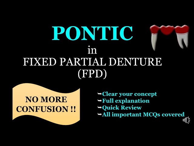 PONTIC IN FIXED PARTIAL DENTURE (FPD) class=