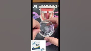 Fix your smile fast! Easy-to-use moldable tooth kit for temporary repairs at home #tooth #filling