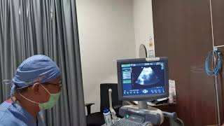 Hasil USG dan Penjelasan Dokter Usia Kehamilan 34 Minggu