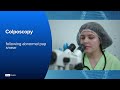 Cervical cancer care