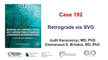 Case 192: Manual of CTO PCI - Retrograde via SVG