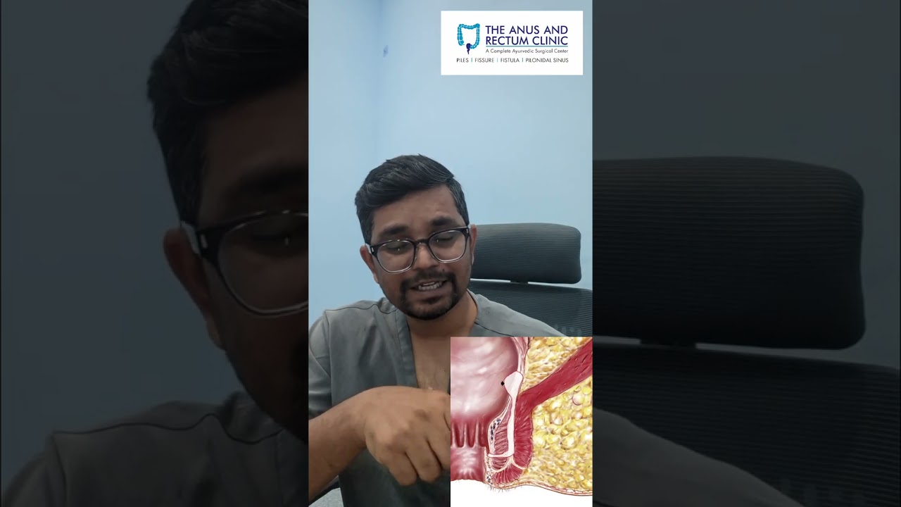 “Unique Ano-Rectal Complaint in a 35-Year Software Engineer After Surgery! | What Went Wrong?”