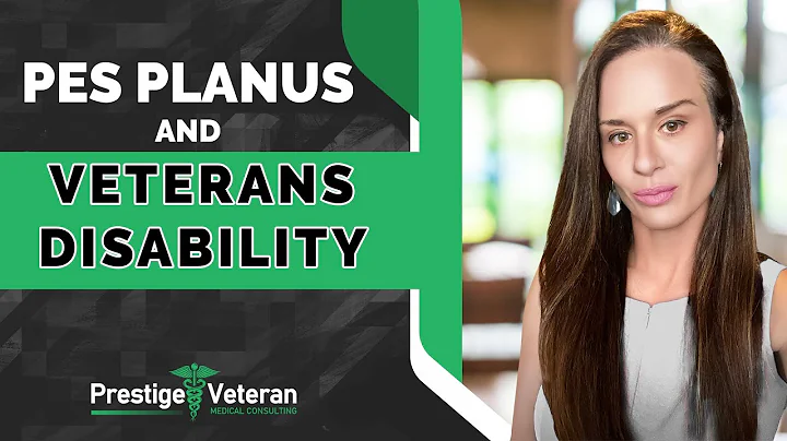 Pes Planus and Veterans Disability | All You Need To Know