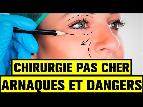 Vidéo: Comment éviter les salons de manucure insalubres : 13 étapes (avec photos)