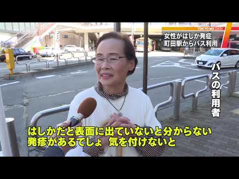 東京・町田市の女性、はしか発症 潜伏期間にバス利用