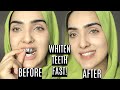 How To Whiten Your Yellow Teeth Naturally At Home | DIY TEETH WHITENING STRIPS ~ Immy