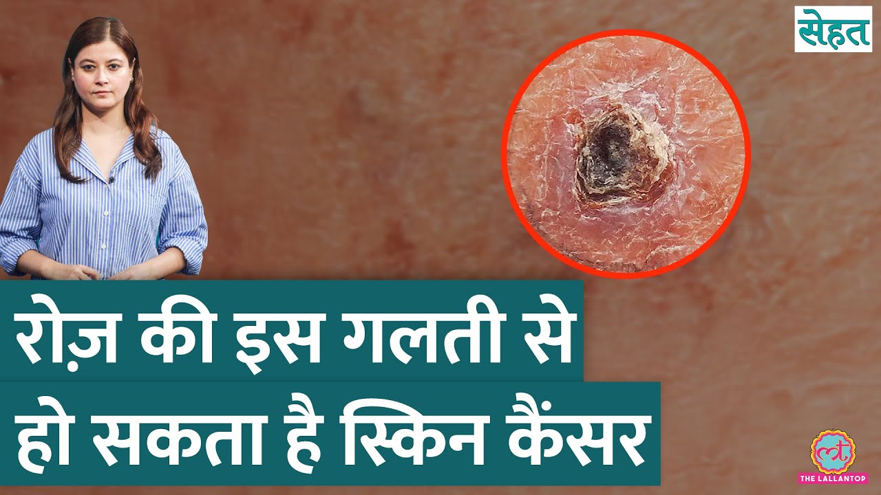 Chef Gordon Ramsay को Skin Cancer, Surgery कराई; बोले, Sunscreen लगाओ | Sehat Ep 1204