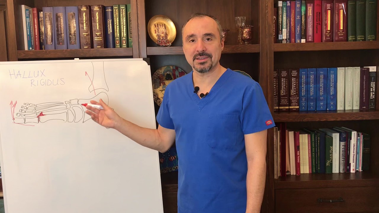 HALLUX RİGİDUS EN YENİ TEDAVİ YÖNTEMİ