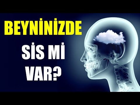 BEYNİNİZDE SİS Mİ VAR?