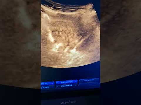 الحلقة الاولى من ابن رحال