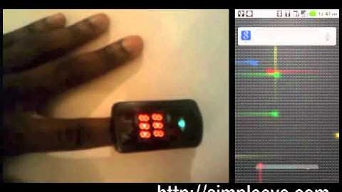 SimpleEye Bluetooth Pulse Oximeter Preview