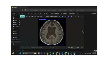 Brain Tumor Detection using Yolo11 and SAM2