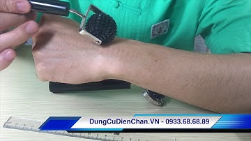 Lăn cầu gai đơn lớn - Lăn cầu đinh đơn lớn Diện Chẩn