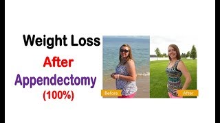 Weight Loss After Appendectomy - How To Lose Weight After Appendix Removal/Surgery