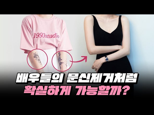 배우들의 문신제거 진짜 이렇게 될 수 있을까?