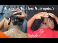 Alopecia/ Hair loss update (It’s been 2 years and I’m back with relaxing my hair)| Lifestyle by Kam