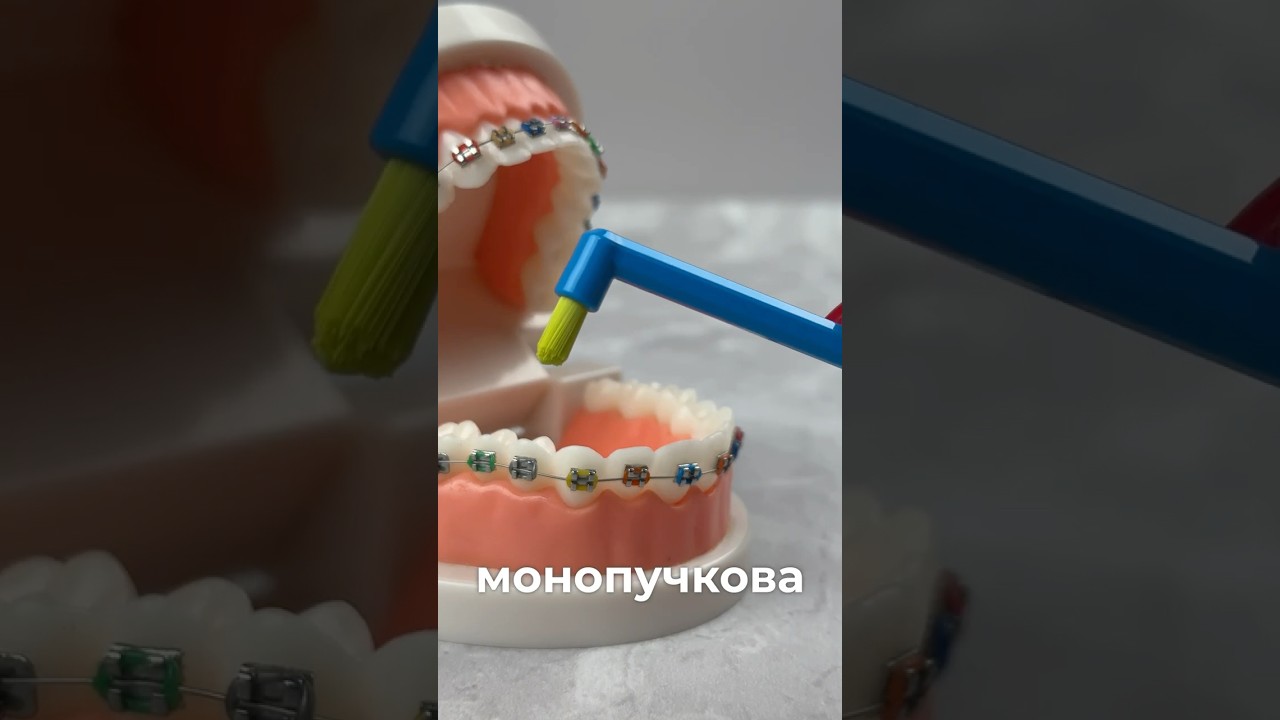 Як правильно користуватися монопучковою щіткою  Інструкція від BELLI DENTI