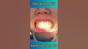 Đố Các Bạn Biết Răng Nào Hỏng Tủy |Dr Cường Offical #bacsicuong #rangsu #viemtuyrang #rangsuthammy