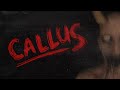 I have NEVER EVER JUMPED THIS HARD BEFORE (Callus)