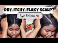 7 ways to TREAT DRY, ITCHY&amp;FLAKY SCALP/DANDRUFF with NO PRODUCT