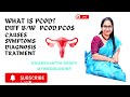 What is PCOD? Difference between PCOD &amp; PCOS! Causes,Symptoms#treatment#Dr.Sravanthi Reddy#obgyn 