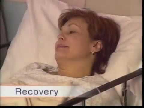 بالفيديو شوف طريقة عملية المنظار العلوي للمرئ والمعدة والاثنى عشر