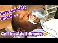 Getting Adult Braces | Husband Gets Metal Braces At Age 50 + | Pricing, Procedure and After Care