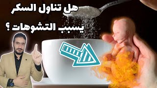 هل تناول السكريات يسبب تشوهات للجنين؟