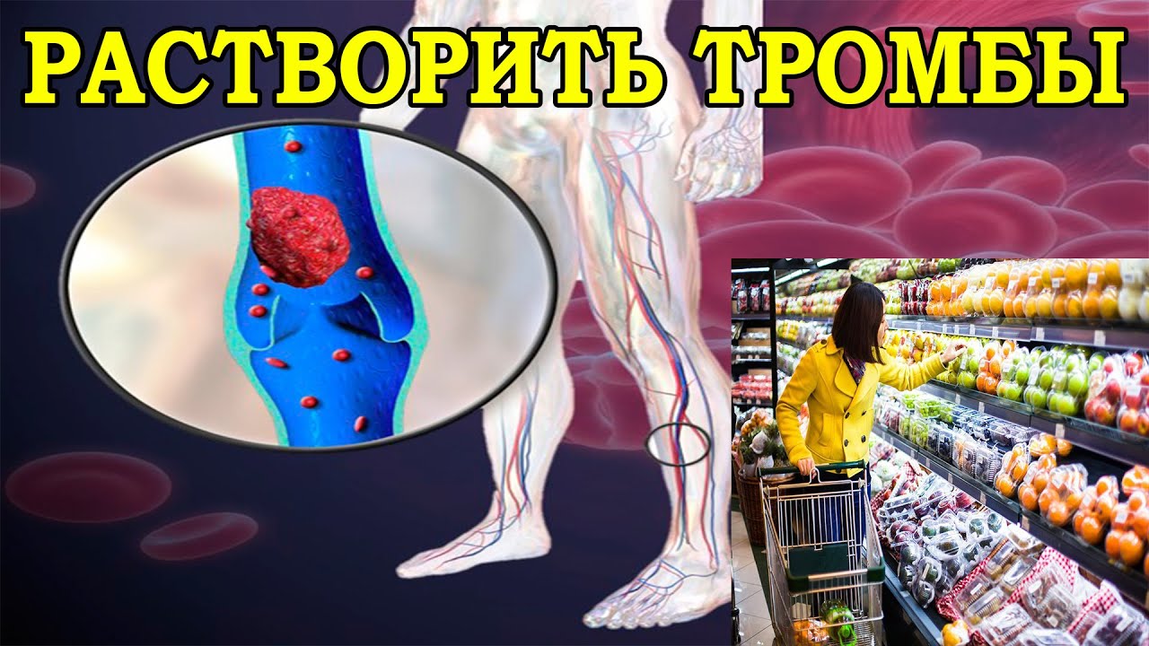 Топ продуктов, разжижающих кровь и препятствующих образованию тромбов.