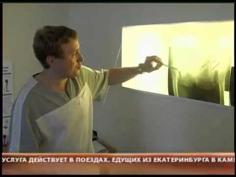 Перелом шейки бедра у пожилых людей