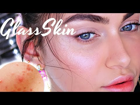 How To Glass Skin For Acne Pimple Prone Skin | Ruby Golani